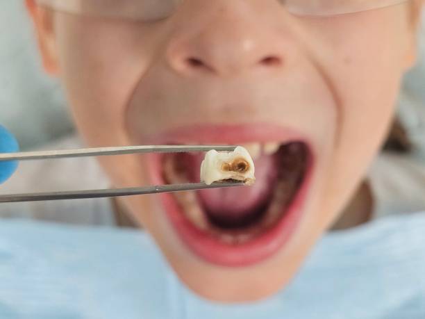 Best Emergency Orthodontic Repairs in Holley, FL
