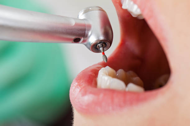 Best Walk-In Emergency Dentist in Holley, FL